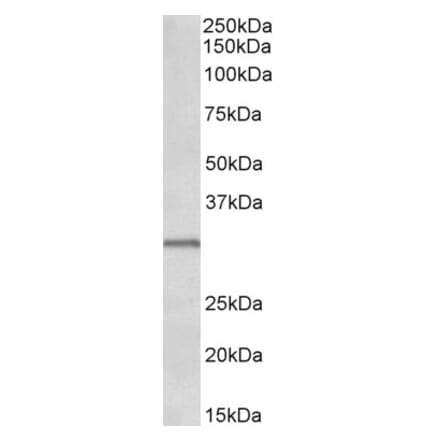 Western Blot - Anti-IGFBP1 Antibody (A85101) - Antibodies.com