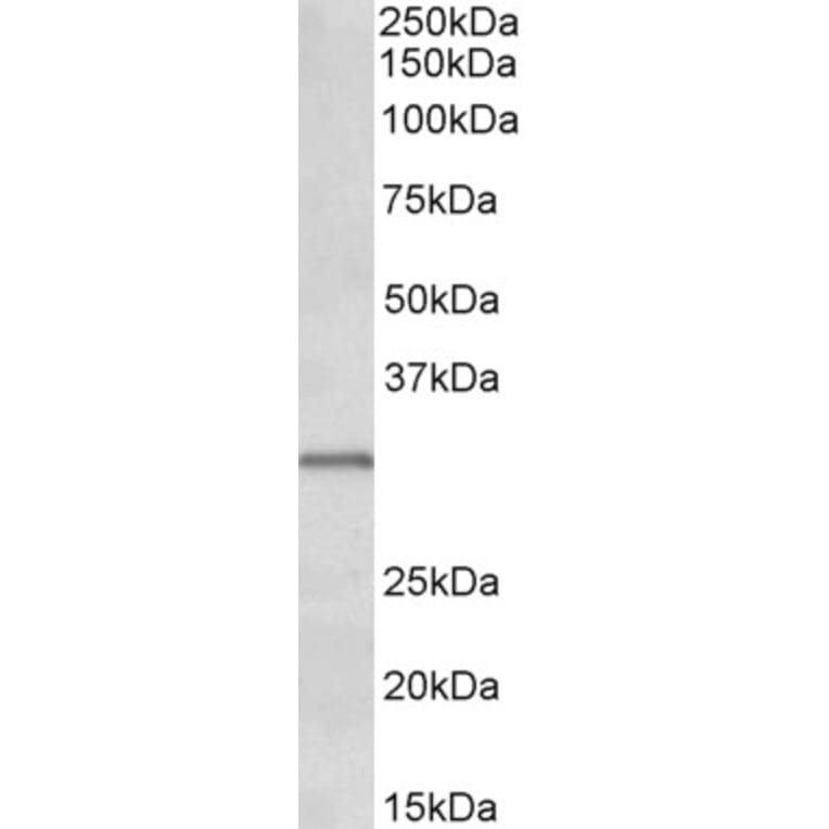 Western Blot - Anti-IGFBP1 Antibody (A85101) - Antibodies.com