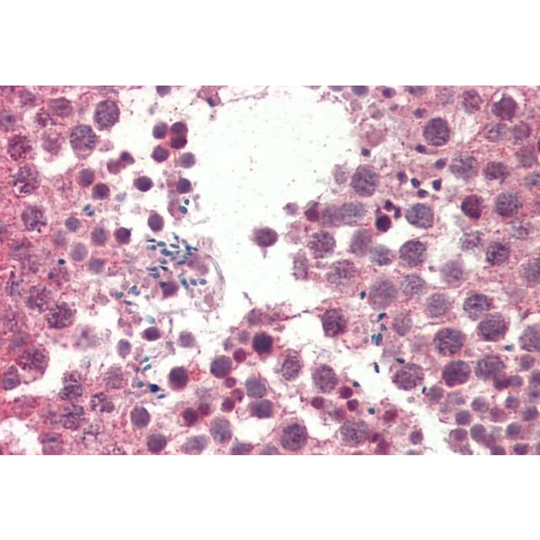 Immunohistochemistry - Anti-IGFBP1 Antibody (A85101) - Antibodies.com