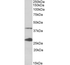 Western Blot - Anti-UPD Antibody (A85102) - Antibodies.com