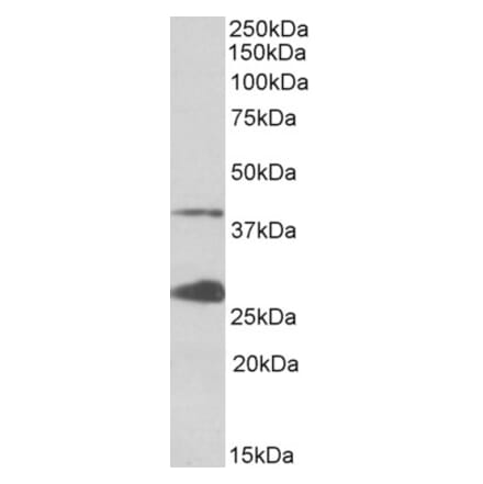 Western Blot - Anti-UPD Antibody (A85102) - Antibodies.com