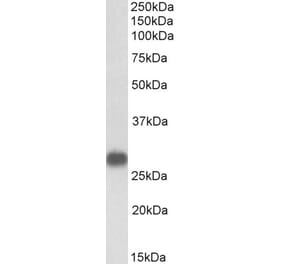 Western Blot - Anti-Cardiac Troponin I Antibody (A85103) - Antibodies.com