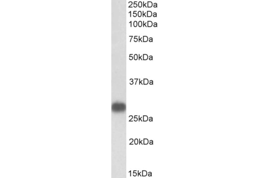 Western Blot - Anti-Cardiac Troponin I Antibody (A85103) - Antibodies.com