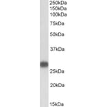 Western Blot - Anti-Cardiac Troponin I Antibody (A85103) - Antibodies.com
