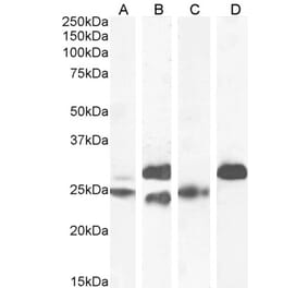 Western Blot - Anti-Cardiac Troponin I Antibody (A85104) - Antibodies.com