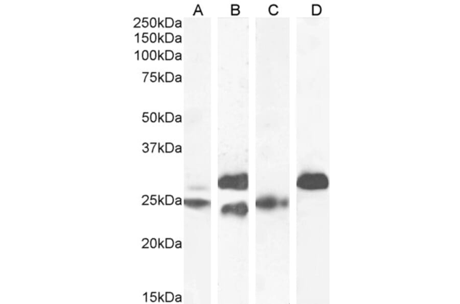 Western Blot - Anti-Cardiac Troponin I Antibody (A85104) - Antibodies.com