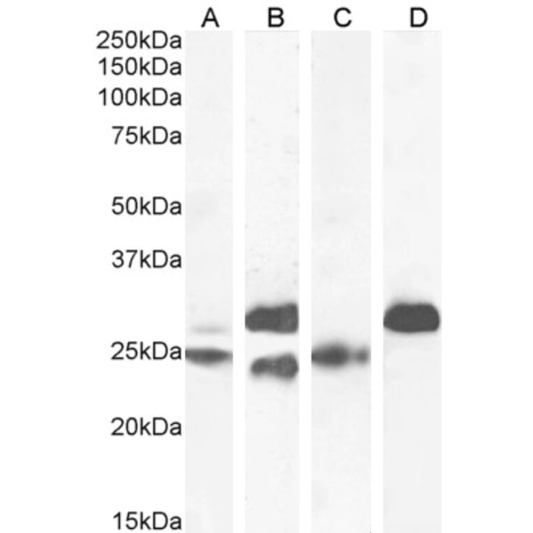 Western Blot - Anti-Cardiac Troponin I Antibody (A85104) - Antibodies.com