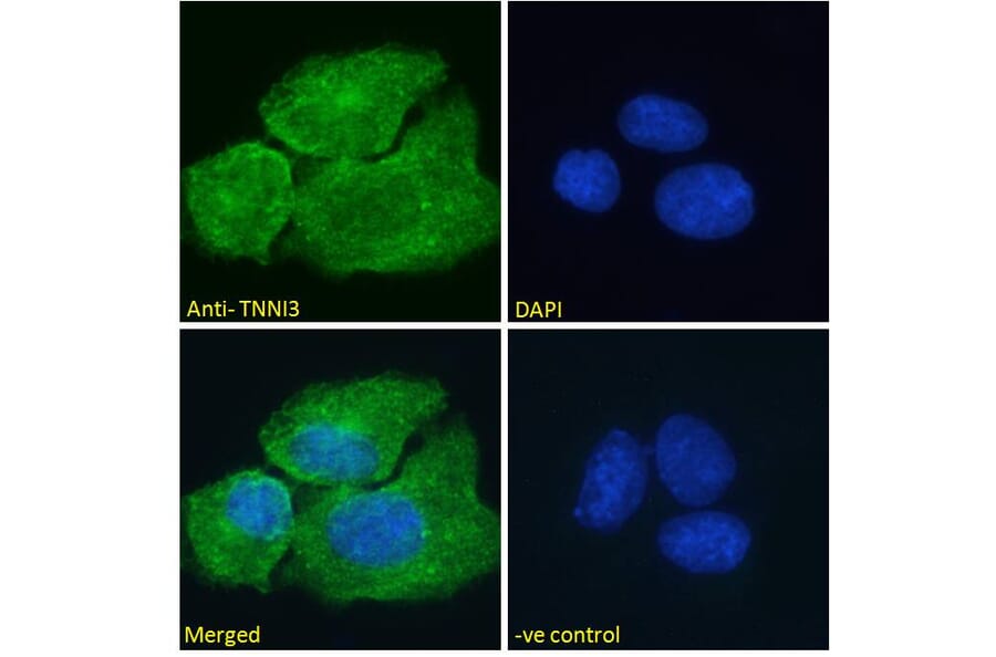 Immunofluorescence - Anti-Cardiac Troponin I Antibody (A85104) - Antibodies.com