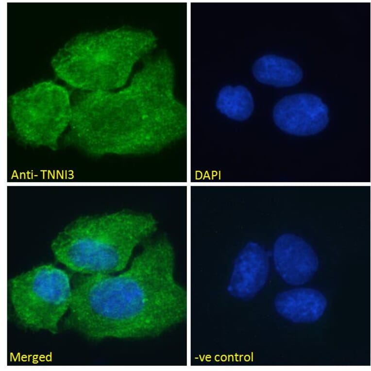 Immunofluorescence - Anti-Cardiac Troponin I Antibody (A85104) - Antibodies.com