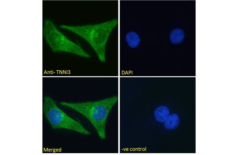 Immunofluorescence - Anti-Cardiac Troponin I Antibody (A85104) - Antibodies.com