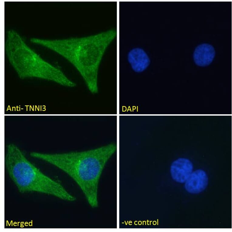 Immunofluorescence - Anti-Cardiac Troponin I Antibody (A85104) - Antibodies.com