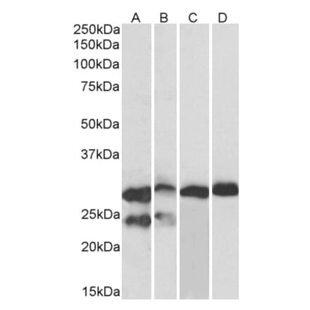 Western Blot - Anti-TNNI3 Antibody (A85104) - Antibodies.com