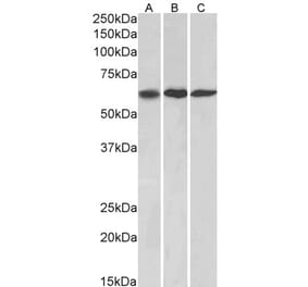 Western Blot - Anti-MMP14 Antibody (A85106) - Antibodies.com