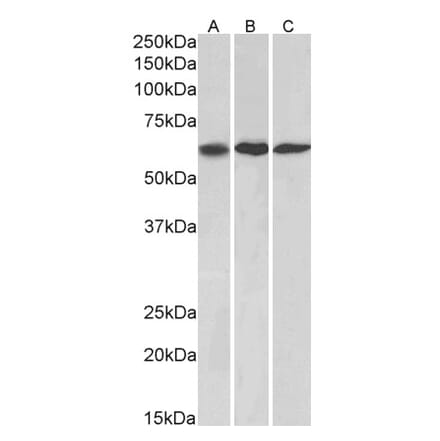 Western Blot - Anti-MMP14 Antibody (A85106) - Antibodies.com