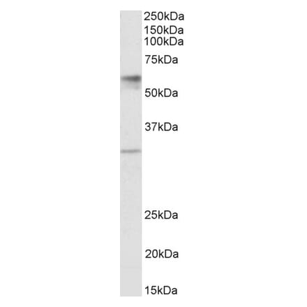 Western Blot - Anti-SLC17A5 Antibody (A85108) - Antibodies.com