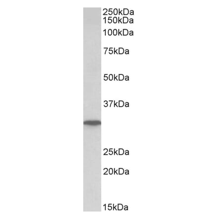 Western Blot - Anti-Nucleoside Phosphorylase Antibody (A85109) - Antibodies.com