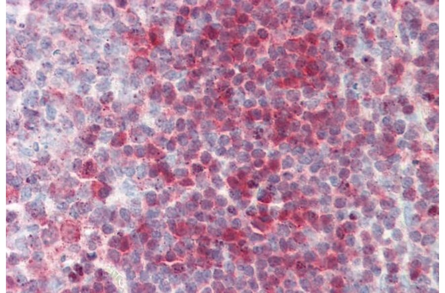 Immunohistochemistry - Anti-Nucleoside Phosphorylase Antibody (A85109) - Antibodies.com