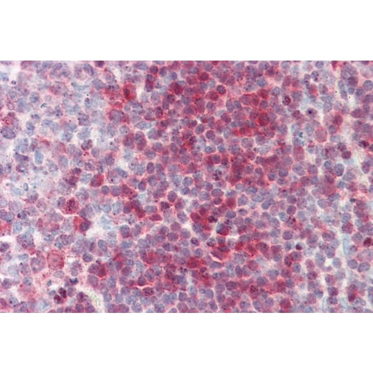 Immunohistochemistry - Anti-Nucleoside Phosphorylase Antibody (A85109) - Antibodies.com