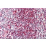 Immunohistochemistry - Anti-Nucleoside Phosphorylase Antibody (A85109) - Antibodies.com