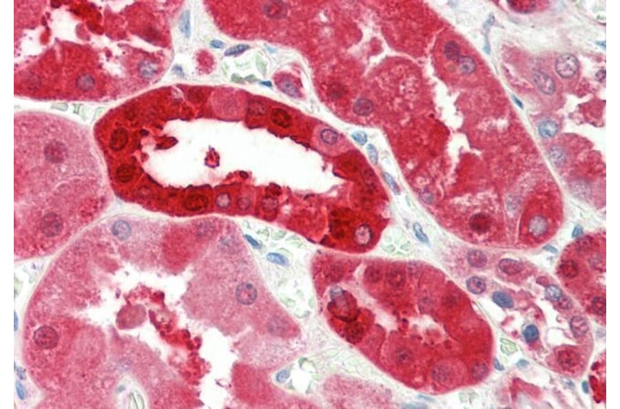 Immunohistochemistry - Anti-Nucleoside Phosphorylase Antibody (A85109) - Antibodies.com