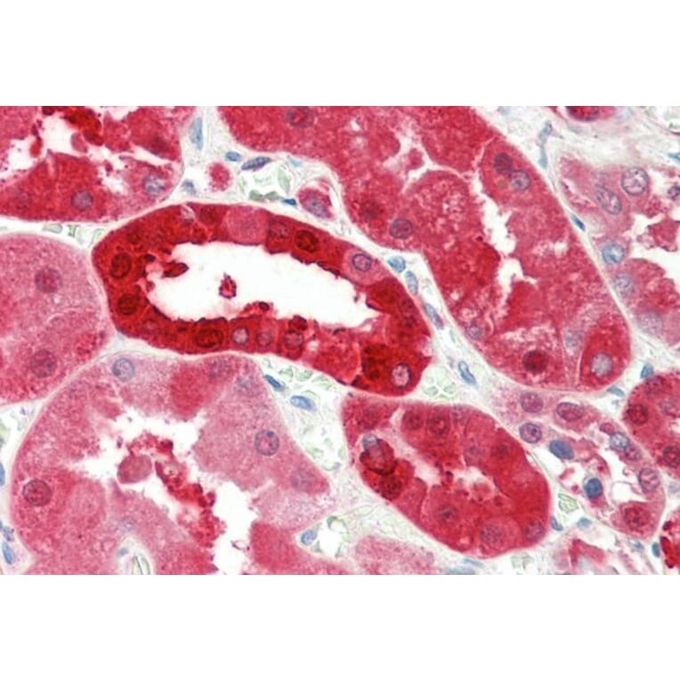 Immunohistochemistry - Anti-Nucleoside Phosphorylase Antibody (A85109) - Antibodies.com