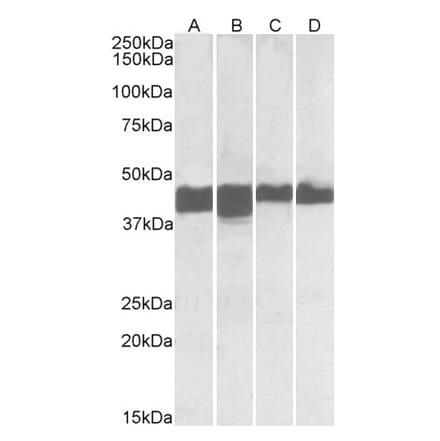 Western Blot - Anti-Creatine Kinase MM Antibody (A85110) - Antibodies.com