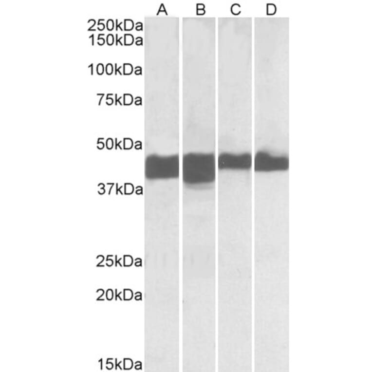 Western Blot - Anti-Creatine Kinase MM Antibody (A85110) - Antibodies.com