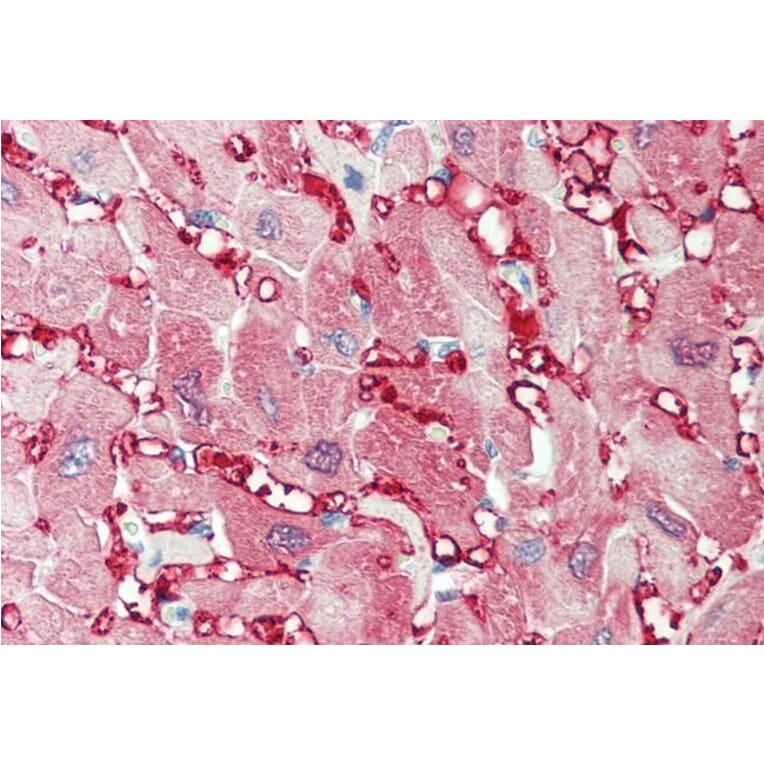 Immunohistochemistry - Anti-Creatine Kinase MM Antibody (A85110) - Antibodies.com