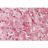 Immunohistochemistry - Anti-Creatine Kinase MM Antibody (A85110) - Antibodies.com