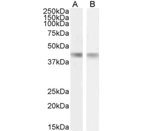 Western Blot - Anti-Creatine Kinase MM Antibody (A85111)