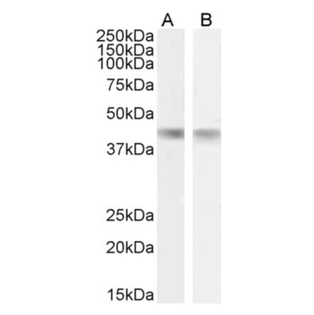 Western Blot - Anti-Creatine Kinase MM Antibody (A85111)