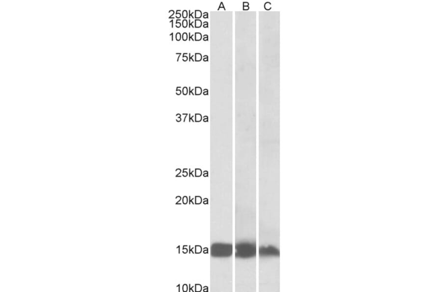 Western Blot - Anti-H-FABP Antibody (A85112) - Antibodies.com