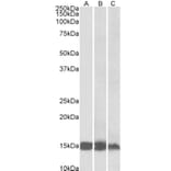 Western Blot - Anti-H-FABP Antibody (A85112) - Antibodies.com
