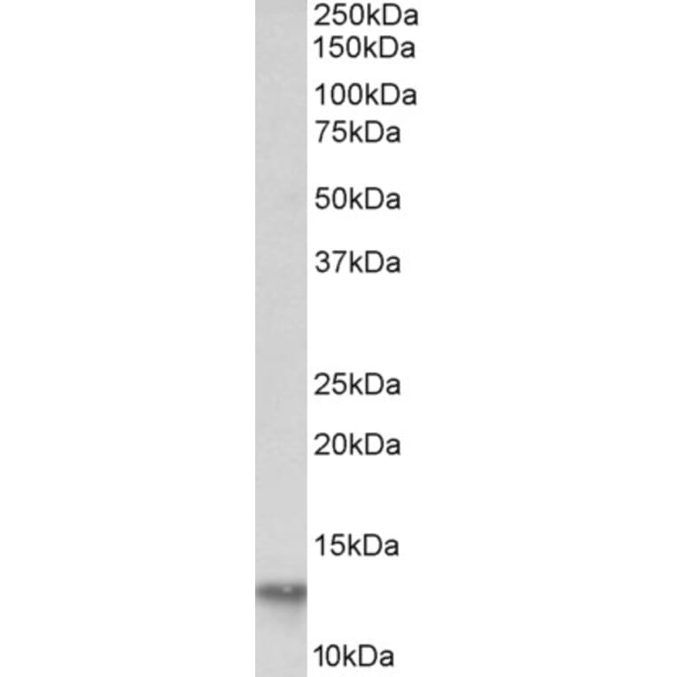 Western Blot - Anti-FABP4 Antibody (A85113) - Antibodies.com