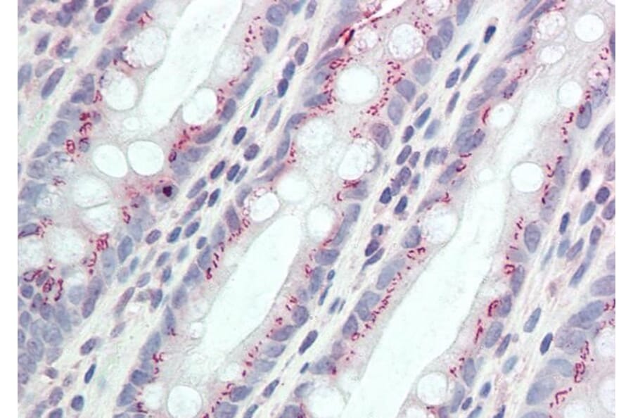 Immunohistochemistry - Anti-CCDC3 Antibody (A85114) - Antibodies.com