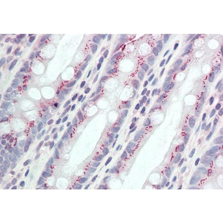 Immunohistochemistry - Anti-CCDC3 Antibody (A85114) - Antibodies.com