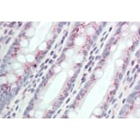 Immunohistochemistry - Anti-CCDC3 Antibody (A85114) - Antibodies.com
