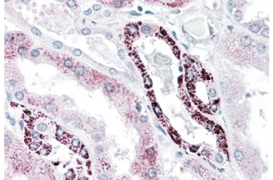 Immunohistochemistry - Anti-PLK3 Antibody (A85115) - Antibodies.com