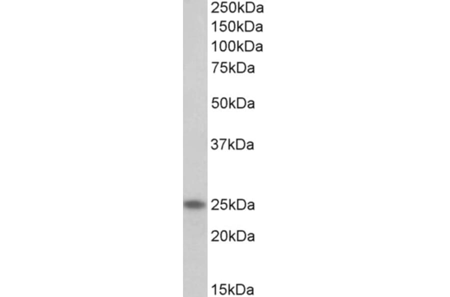Western Blot - Anti-TNNI1 Antibody (A85117) - Antibodies.com