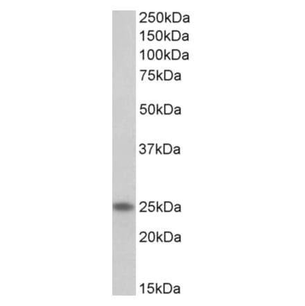 Western Blot - Anti-TNNI1 Antibody (A85117) - Antibodies.com