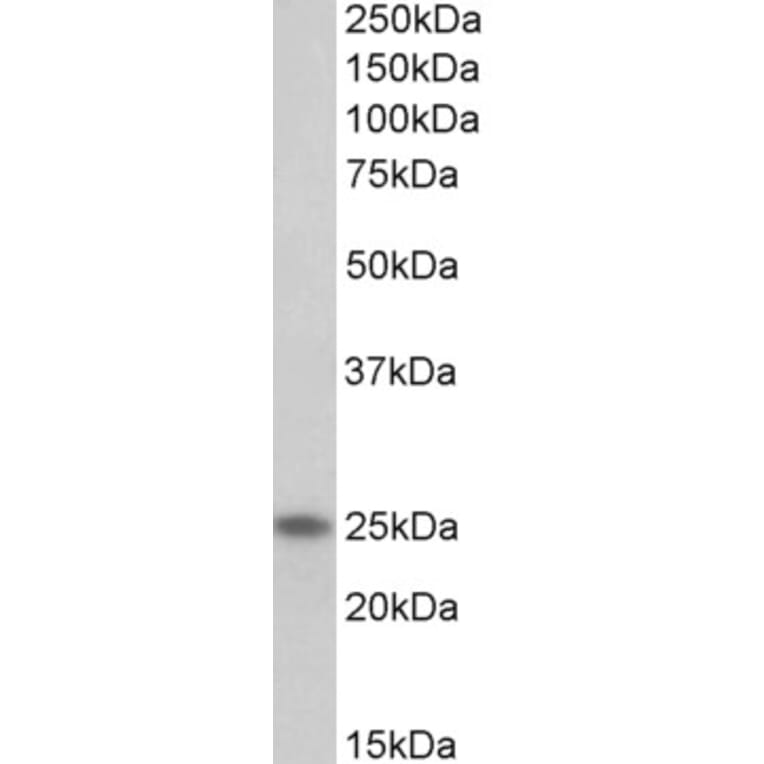 Western Blot - Anti-TNNI1 Antibody (A85117) - Antibodies.com