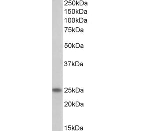 Western Blot - Anti-TNNI1 Antibody (A85117) - Antibodies.com