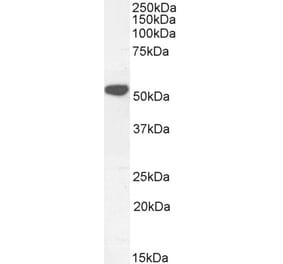 Western Blot - Anti-KATNAL2 Antibody (A85118) - Antibodies.com