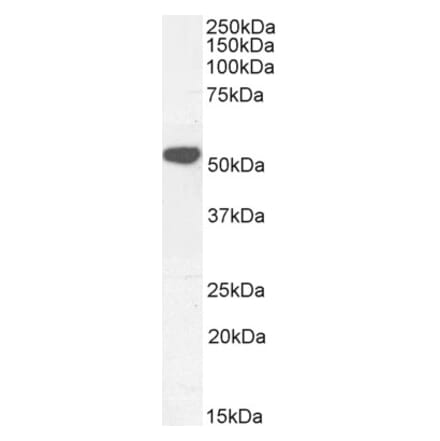 Western Blot - Anti-KATNAL2 Antibody (A85118) - Antibodies.com