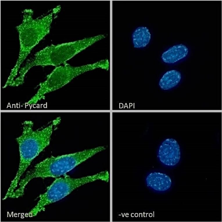 Immunofluorescence - Anti-TMS1/ASC Antibody (A85119) - Antibodies.com