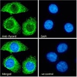 Immunofluorescence - Anti-TMS1/ASC Antibody (A85119) - Antibodies.com