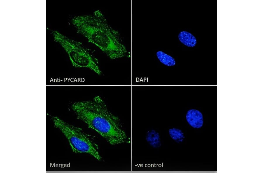 Immunofluorescence - Anti-TMS1/ASC Antibody (A85119) - Antibodies.com