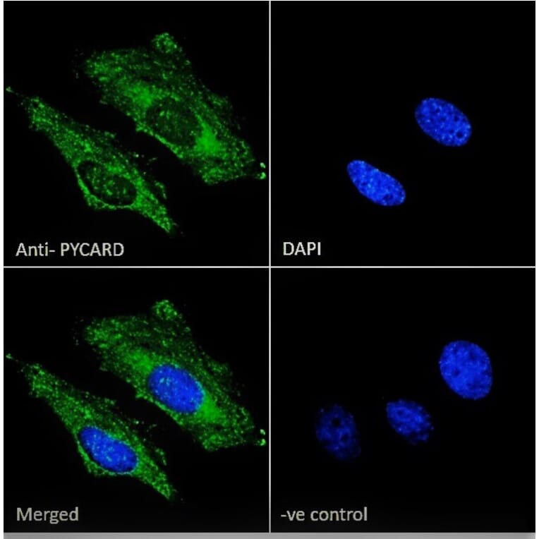 Immunofluorescence - Anti-TMS1/ASC Antibody (A85119) - Antibodies.com