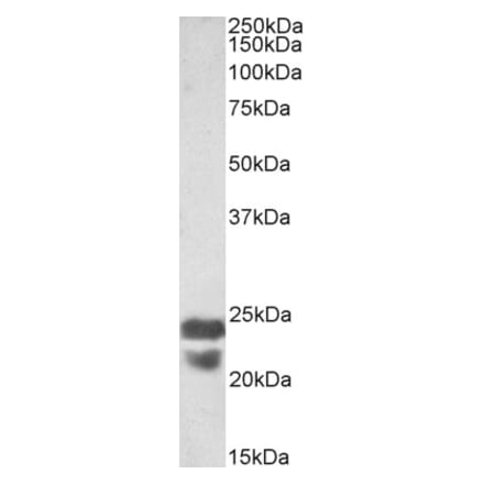 Western Blot - Anti-Pycard Antibody (A85119) - Antibodies.com