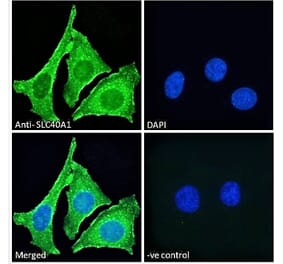 Immunofluorescence - Anti-SLC40A1 Antibody (A85120) - Antibodies.com